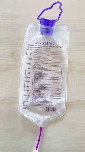 YIKAMALI ENTERAL  BESLENME TORBASI